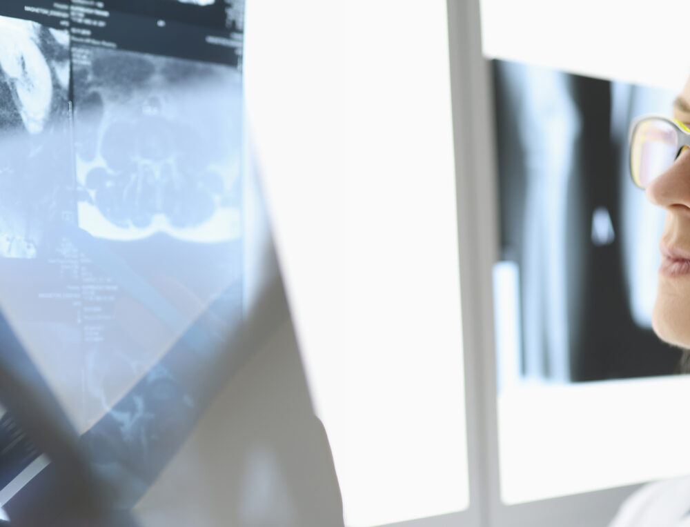 Female doctor examines an X-ray in medical office.